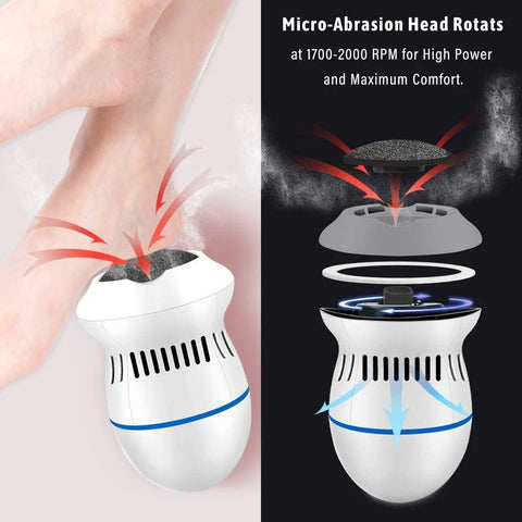 Electric Callus Remover – USB Rechargeable Foot Scrubber with Dual Speed & LED Indicator | Smooth Feet | UAE
