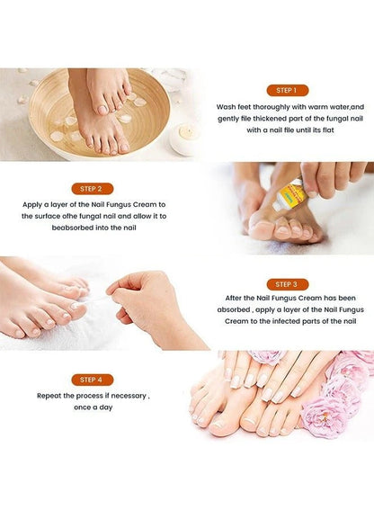 Sumifun Bee Venom Nail Cream 20g – Nail Repair, Strengthen & Whiten