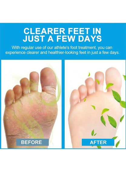 Sumifun Foot Antibacterial Cream 20g – Tea Tree Oil Repair & Nourish