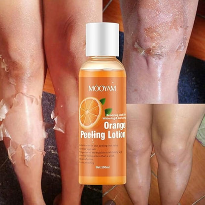 Mooyam Orange Peeling Lotion 100ml – Whitening & Dead Skin Removal