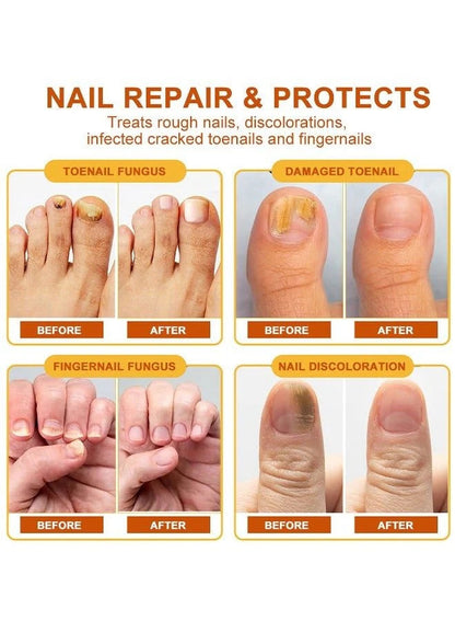 Sumifun Bee Venom Nail Cream 20g – Nail Repair, Strengthen & Whiten