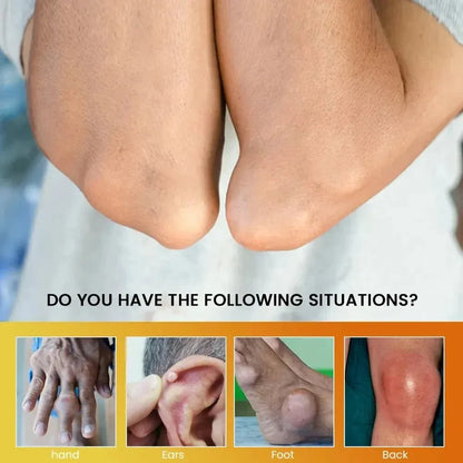 Sumifun Gout Relief Cream 20g – Joint Pain & Swelling Support