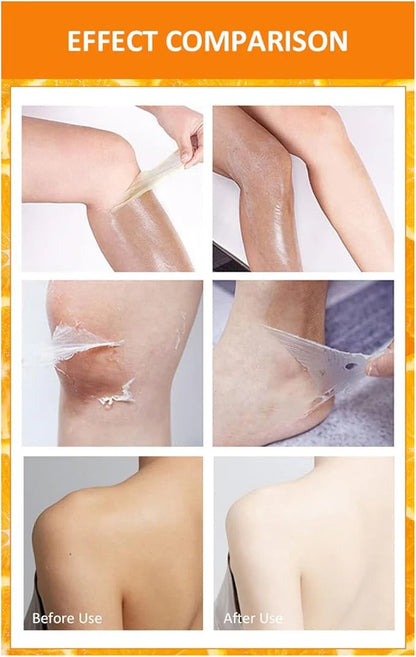 Mooyam Orange Peeling Lotion 100ml – Whitening & Dead Skin Removal